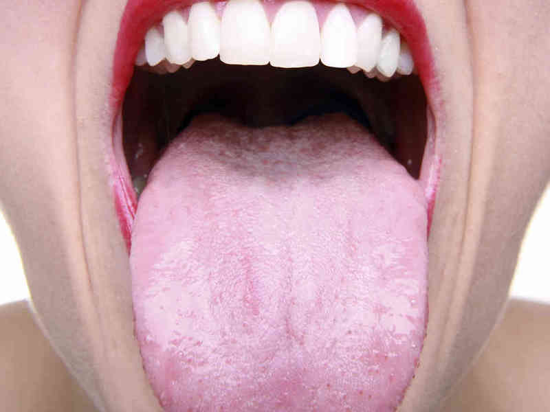 흰 꽃이 혀로 치료 받았습니까?